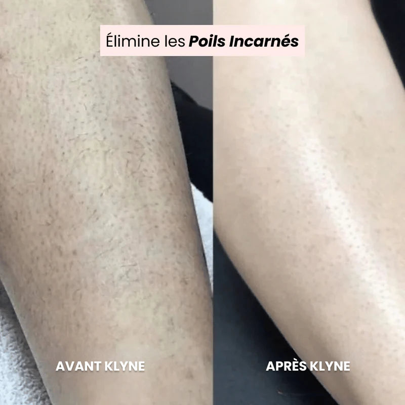 Rasoir tondeuse 2-en-1 KLYNE®