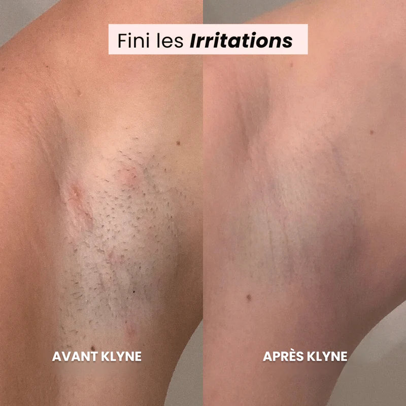 Rasoir tondeuse 2-en-1 KLYNE®